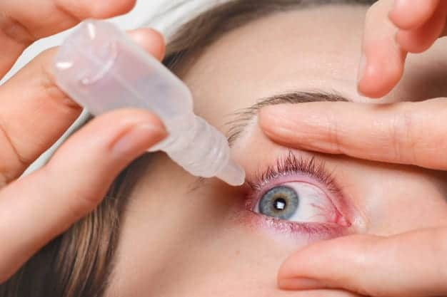 Treatment for Dry Eyes and Irritation: A Complete Easy Guide