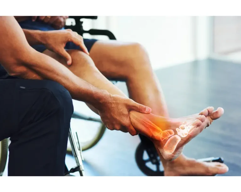 Frequently Asked Questions About Foot and Ankle Wound Care