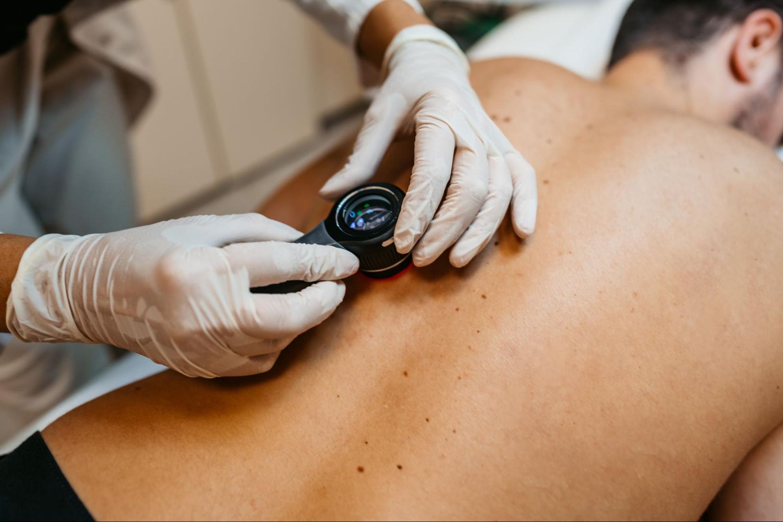 What Makes Mohs Surgery Unique in Skin Cancer Treatment?