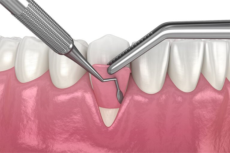 Comprehensive Gum Treatments For Enhanced Oral Health