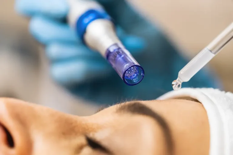 Enhancing Recovery With Platelet Rich Plasma Therapy