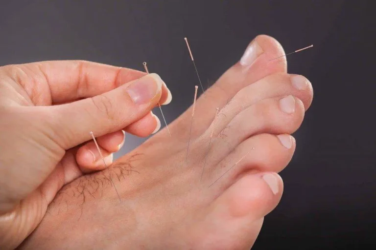 Evaluating the Benefits of Surgery for Severe Plantar Fasciitis