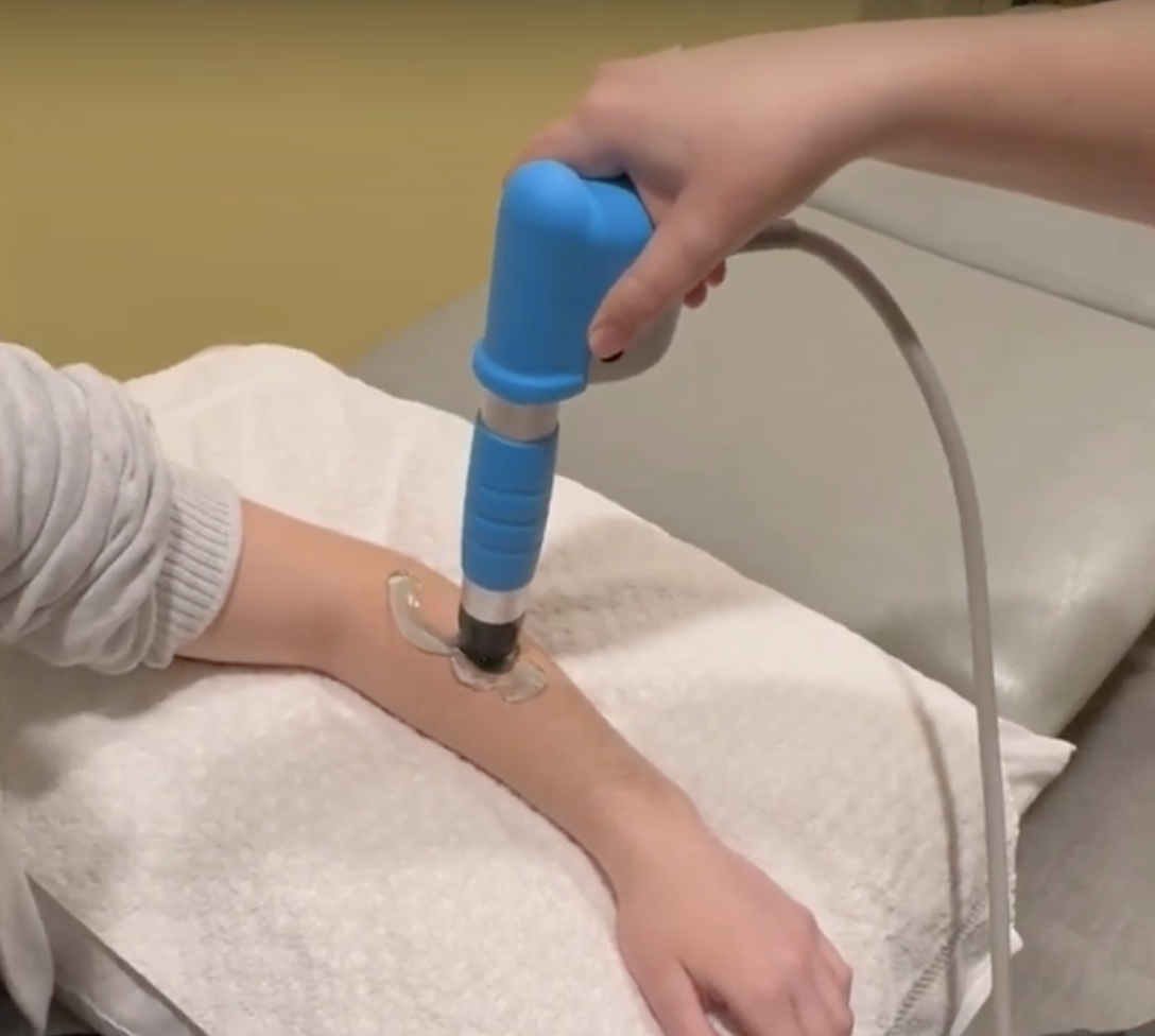 Exploring Shockwave Therapy and How It Works